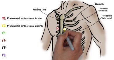 receta de electrocardiograma