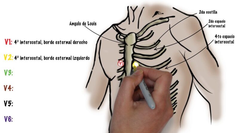 receta de electrocardiograma